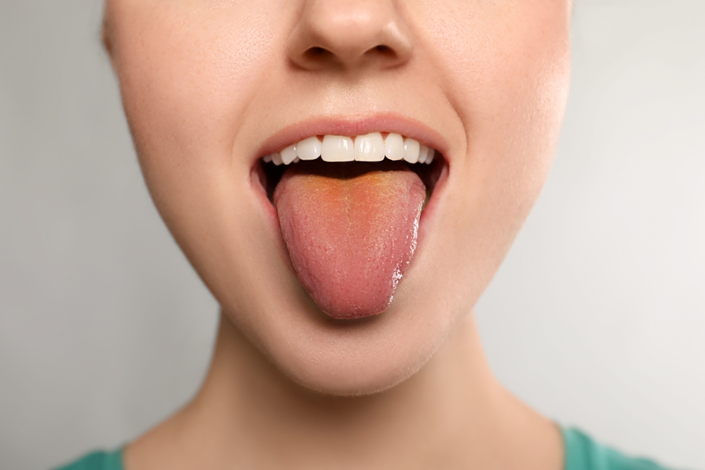 tongue and breathing treatment in cary nc