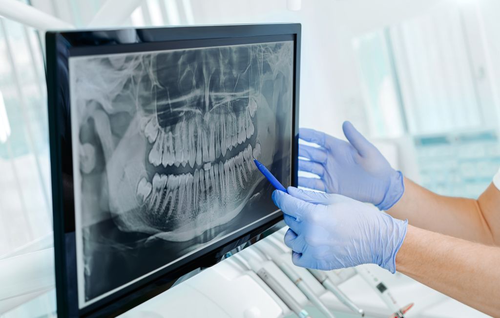 digital x-rays & imaging in cary, nc
