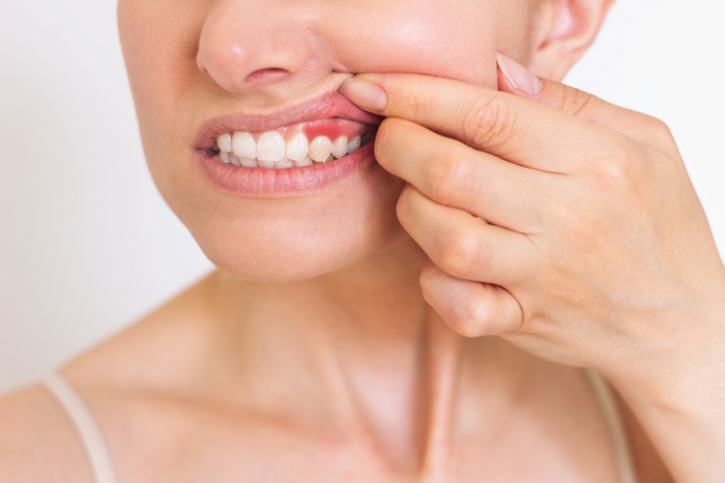 gum therapy in cary, nc