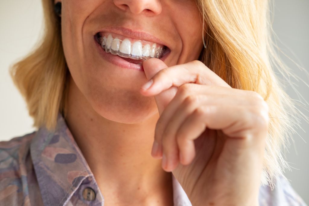 invisalign in cary nc
