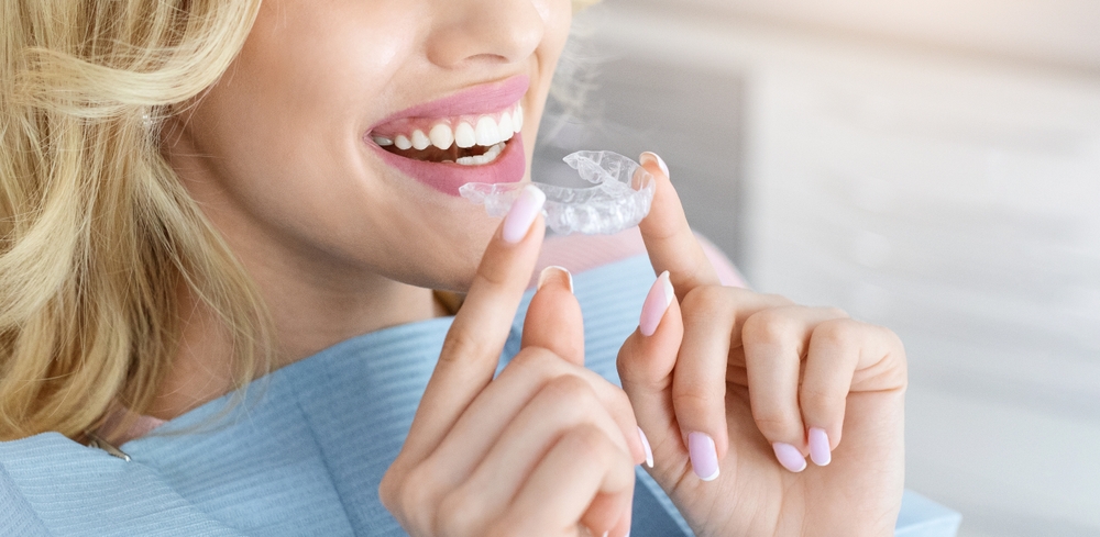 what are the cons of wearing Invisalign?