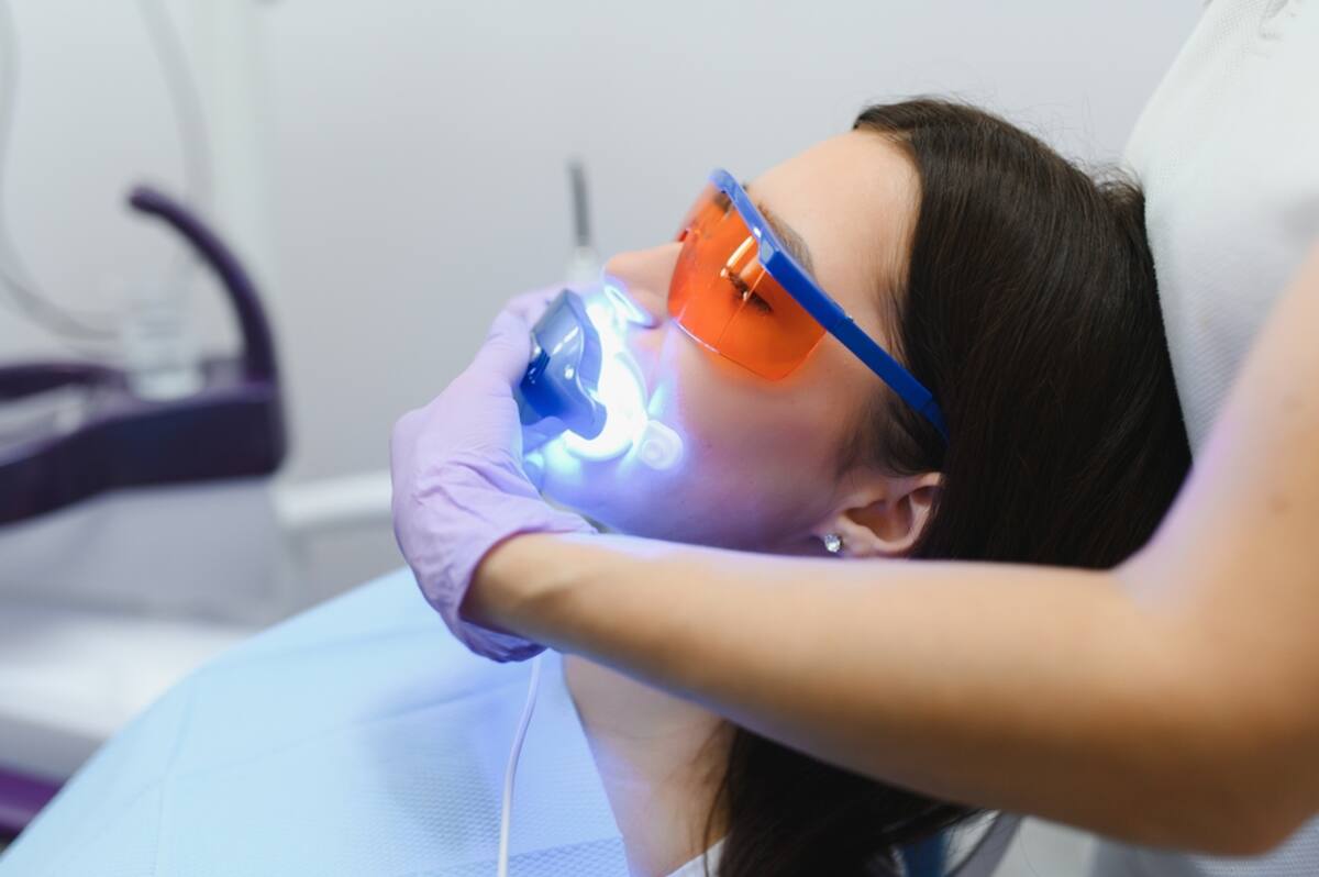 how to maintain your bright smile after teeth whitening
